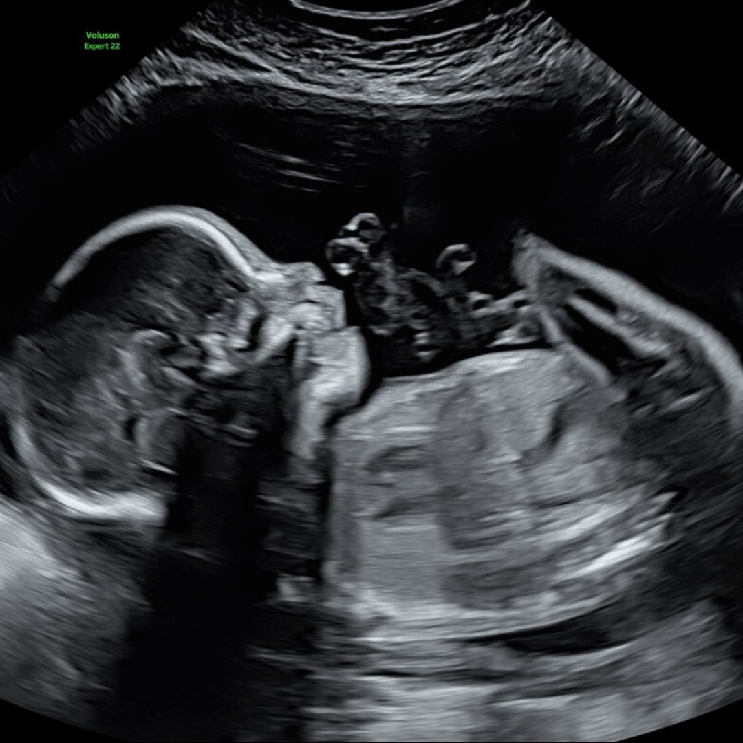 Photo shared by Haley for their Babylist baby registry.