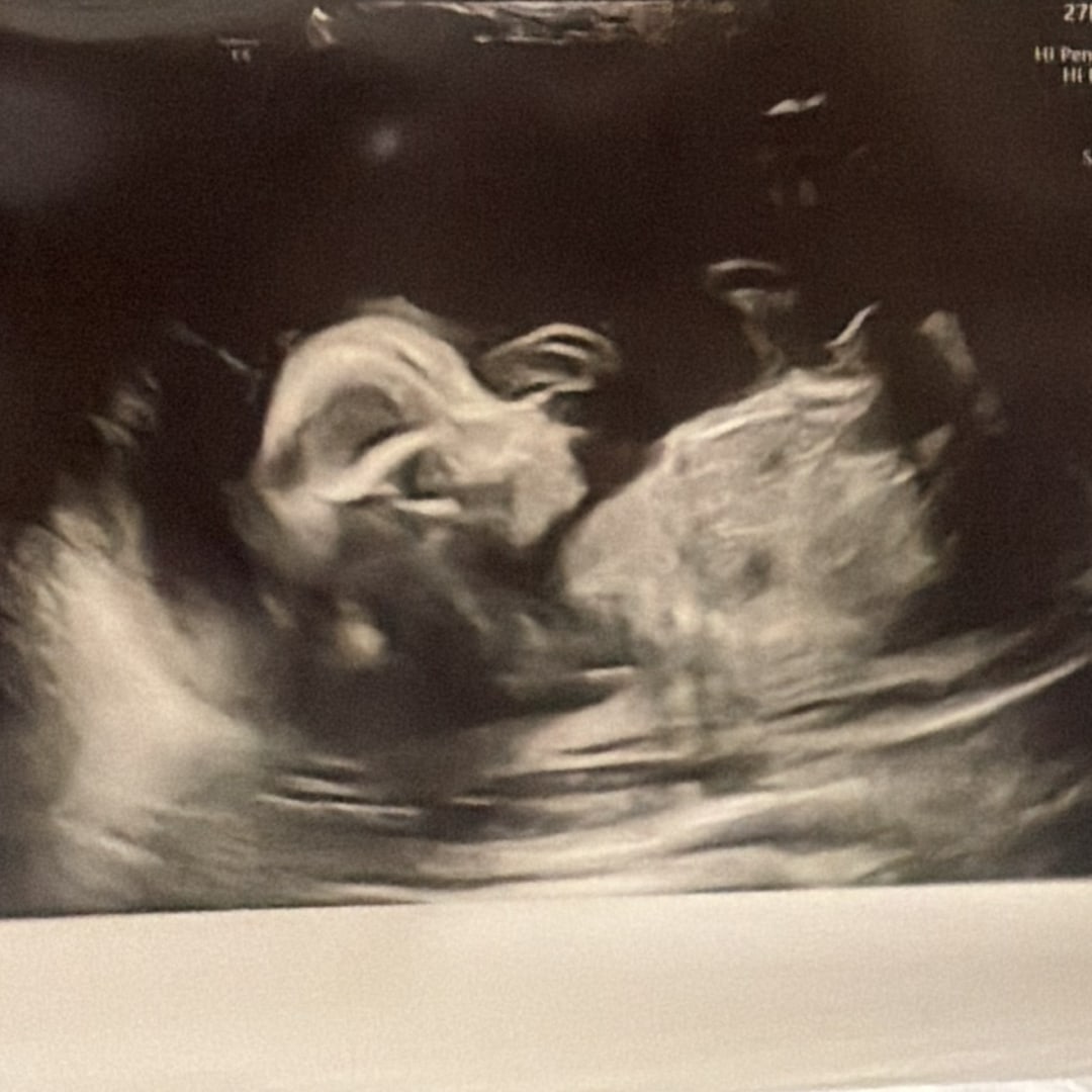 Photo shared by Chastity for their Babylist baby registry.