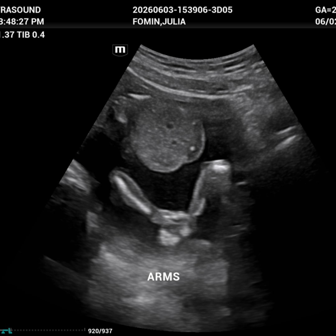 Photo shared by Julia for their Babylist baby registry.