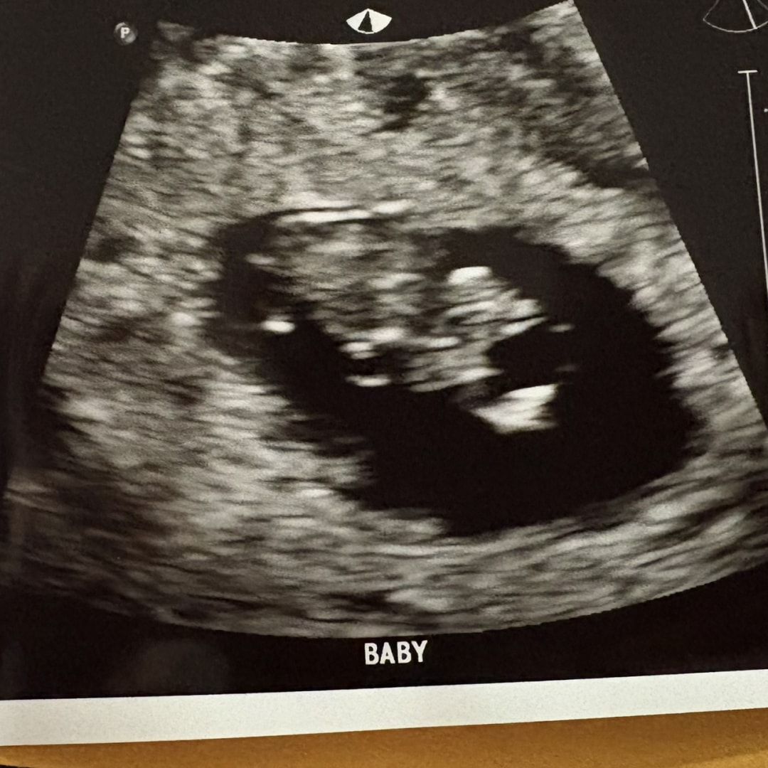 Photo shared by Jocelyne for their Babylist baby registry.