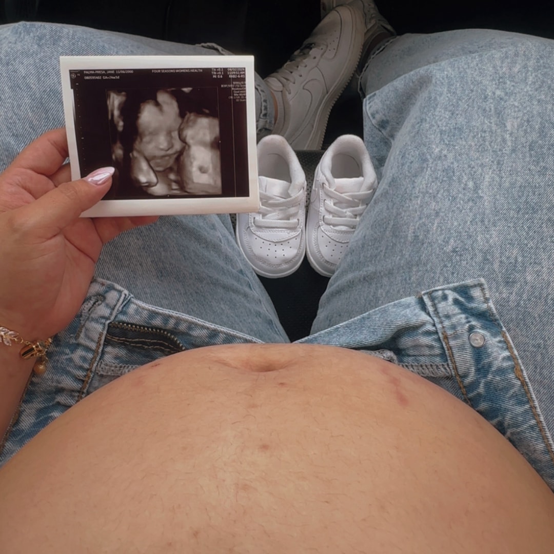 Photo shared by Jane for their Babylist baby registry.