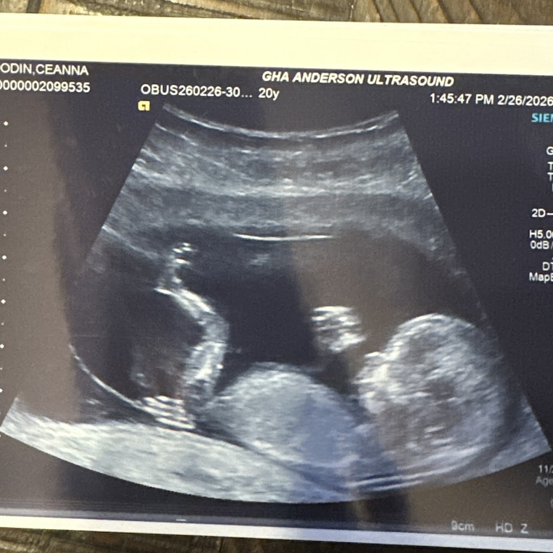Photo shared by Ceanna for their Babylist baby registry.