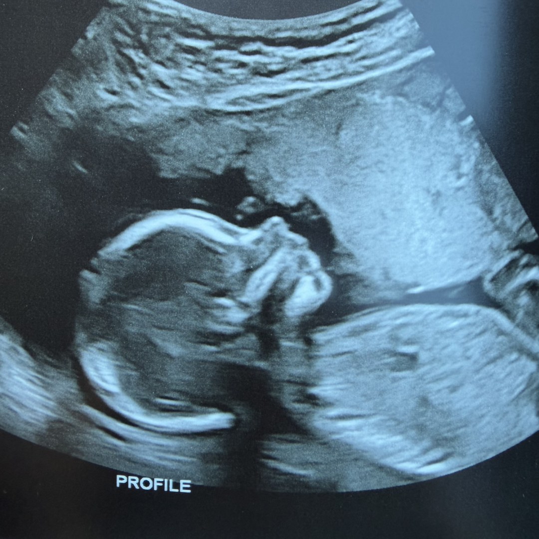 Photo shared by Laken for their Babylist baby registry.