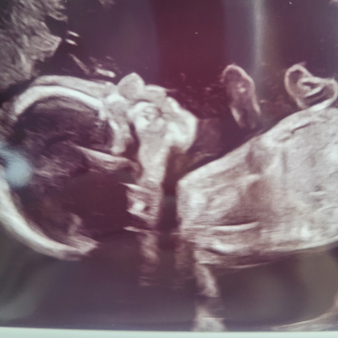 Photo shared by Beatrix Dawn for their Babylist baby registry.