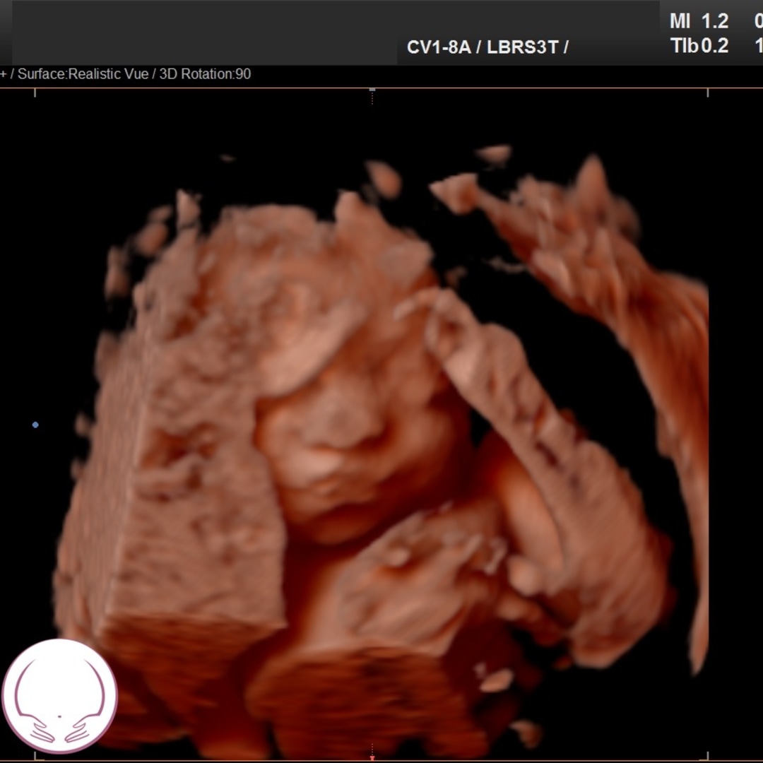 Photo shared by Alejandra for their Babylist baby registry.