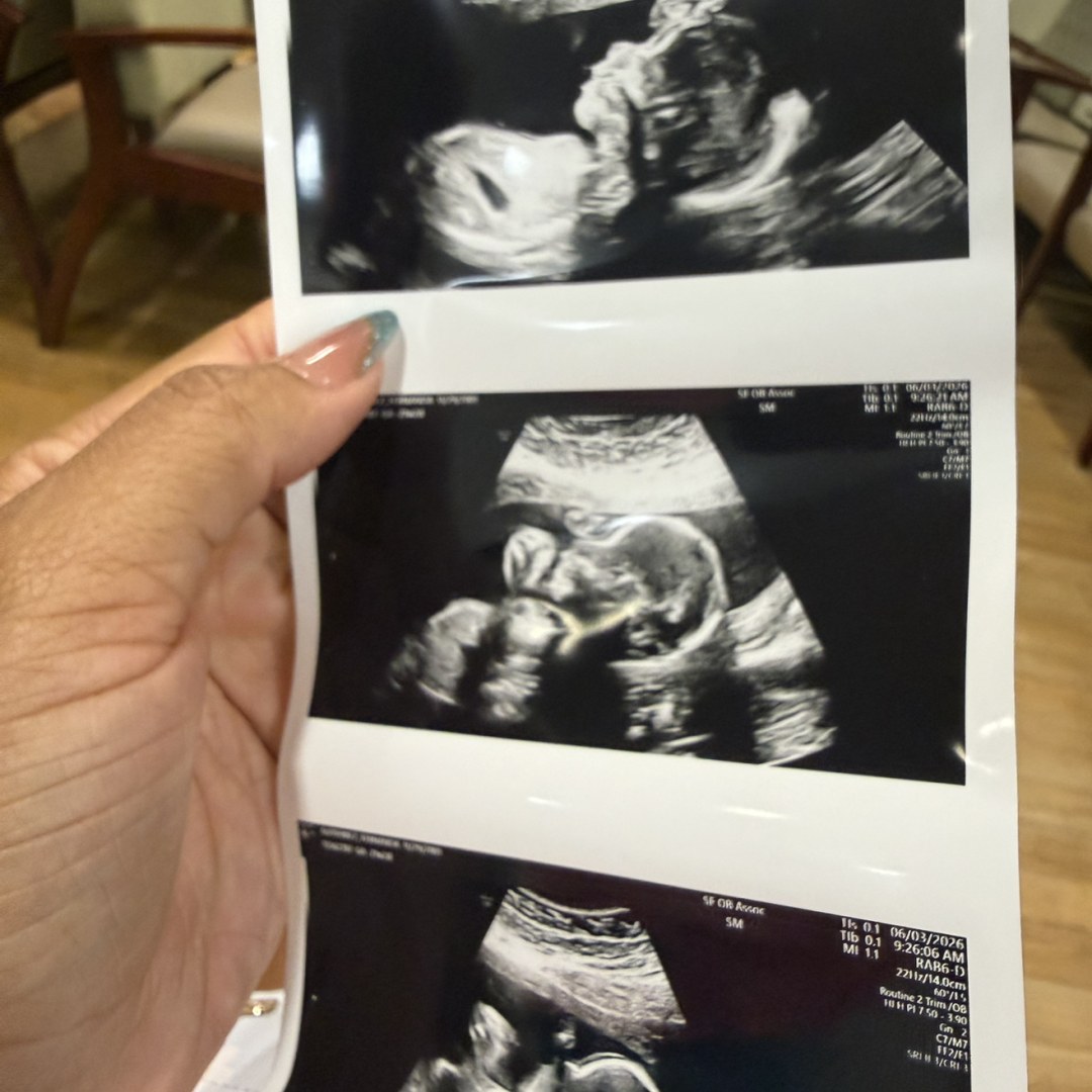 Photo shared by Fernanda for their Babylist baby registry.