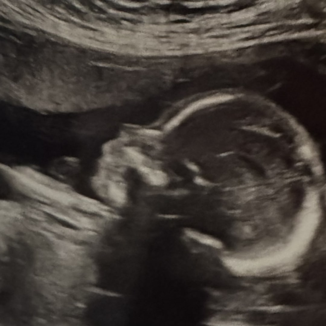 Photo shared by Amy for their Babylist baby registry.