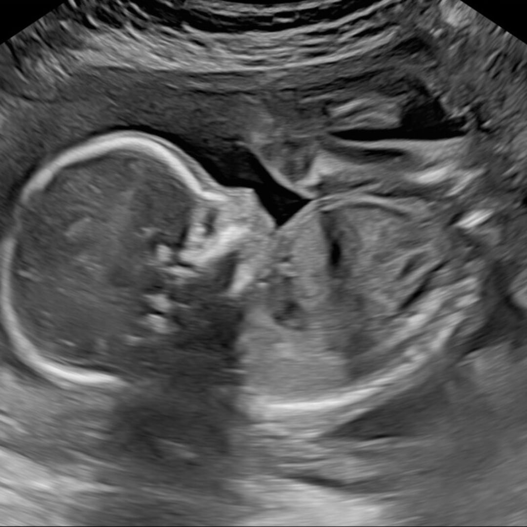 Photo shared by Melissa and Jack for their Babylist baby registry.