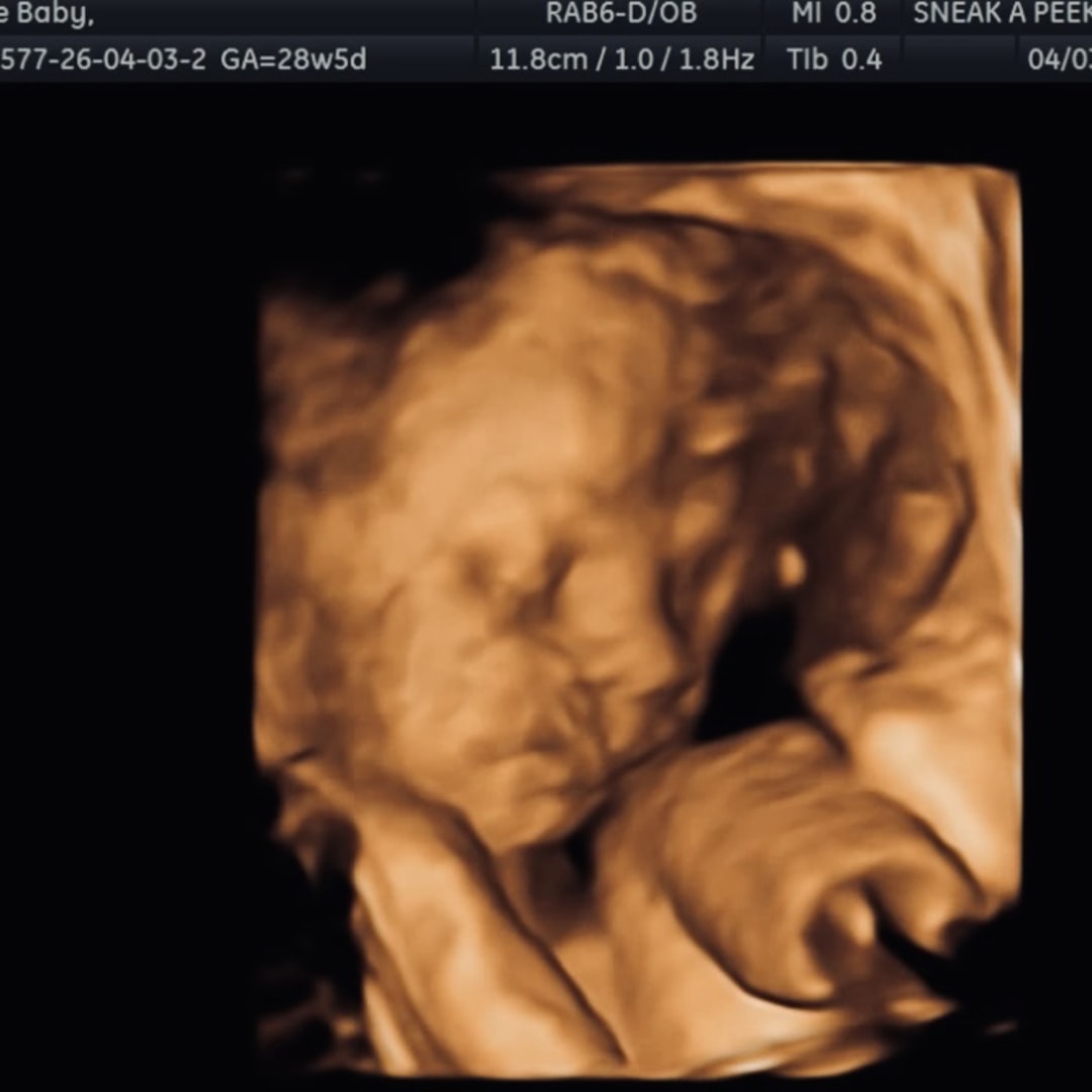 Photo shared by Erin for their Babylist baby registry.