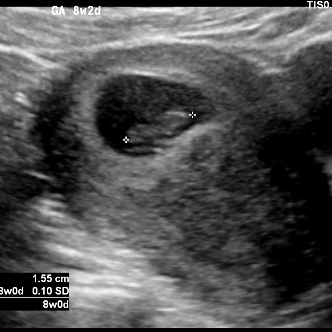 Photo shared by Hannah for their Babylist baby registry.