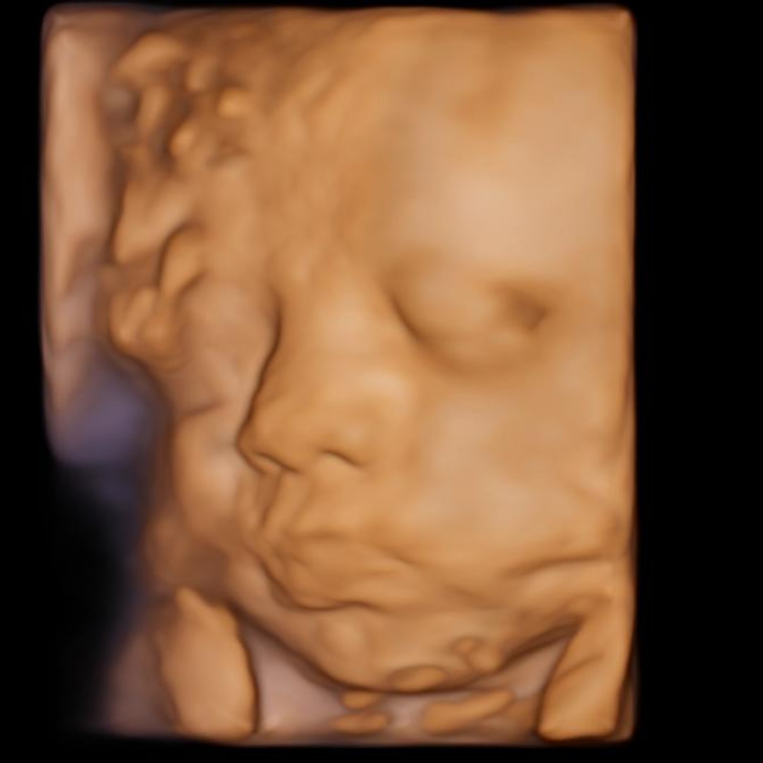 Photo shared by Riley & Gavin for their Babylist baby registry.