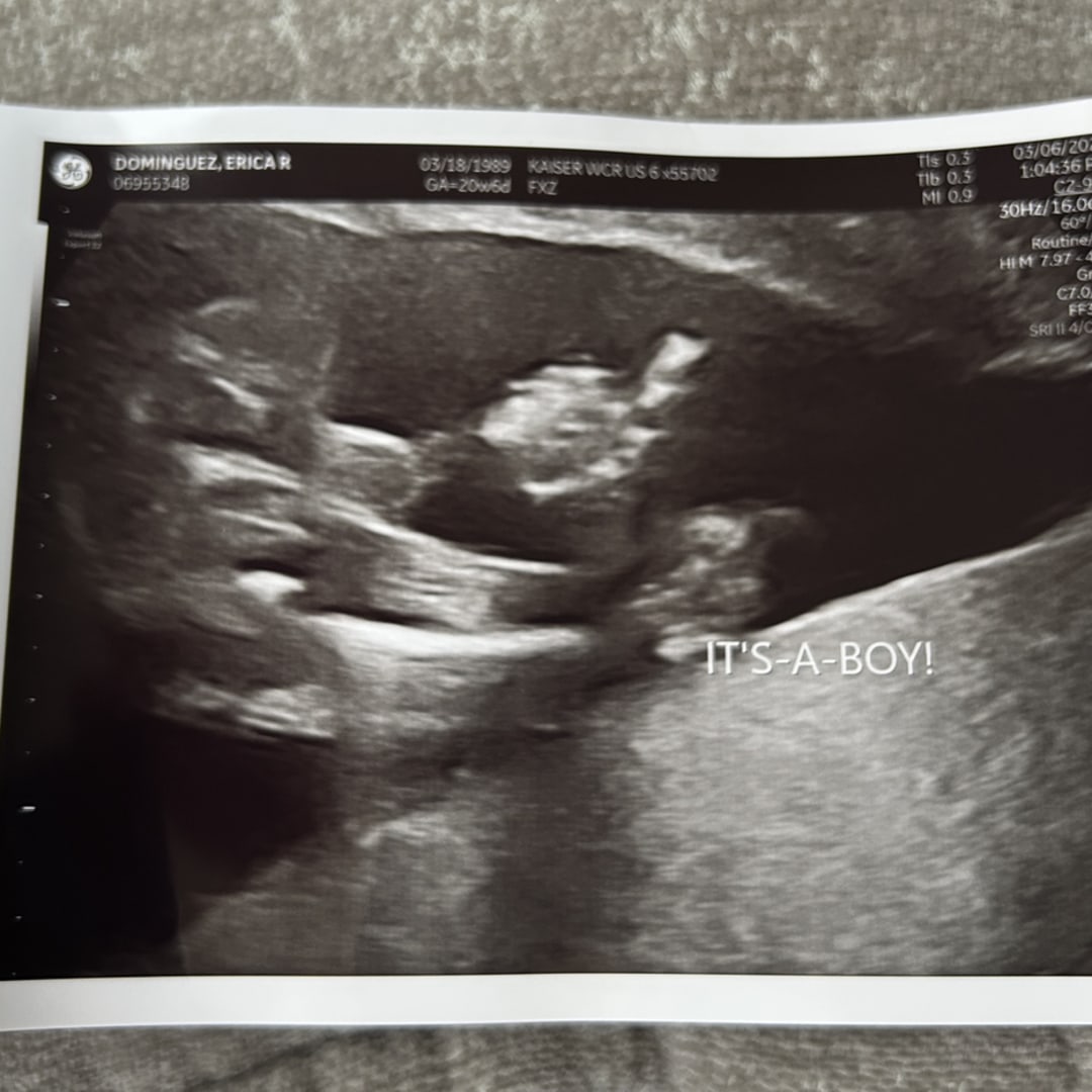 Photo shared by Erica for their Babylist baby registry.