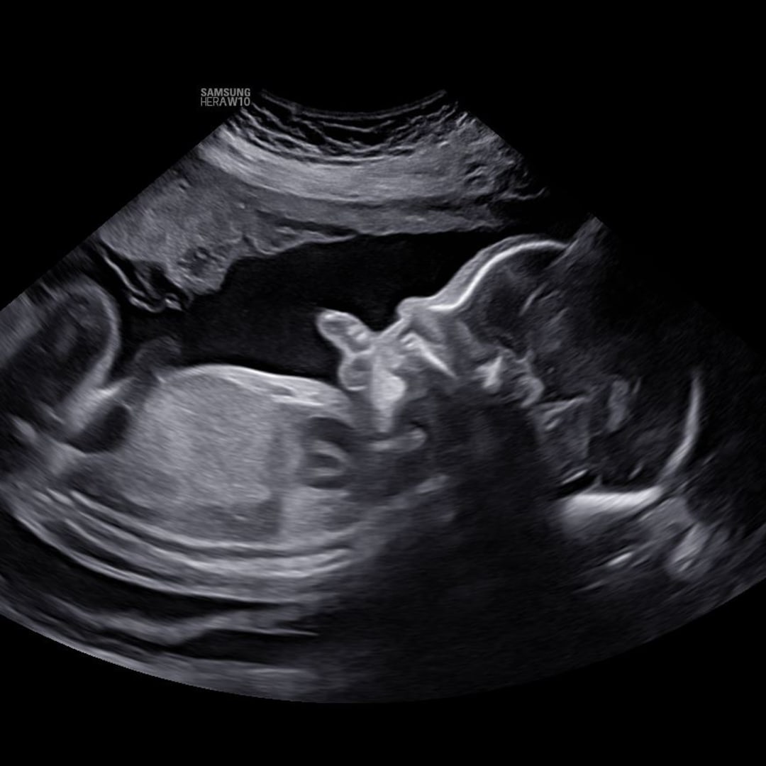 Photo shared by Chelsea for their Babylist baby registry.