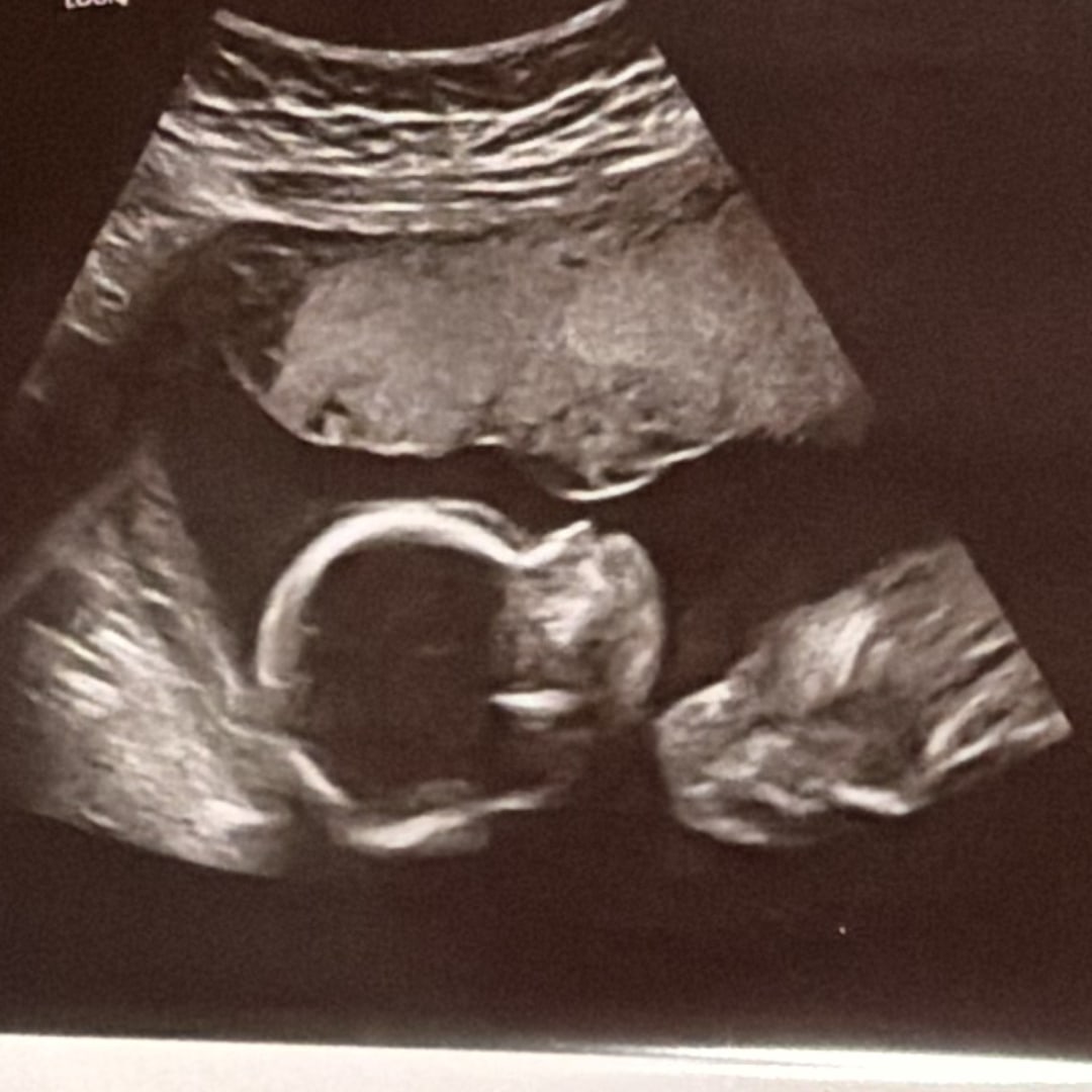 Photo shared by Ava for their Babylist baby registry.