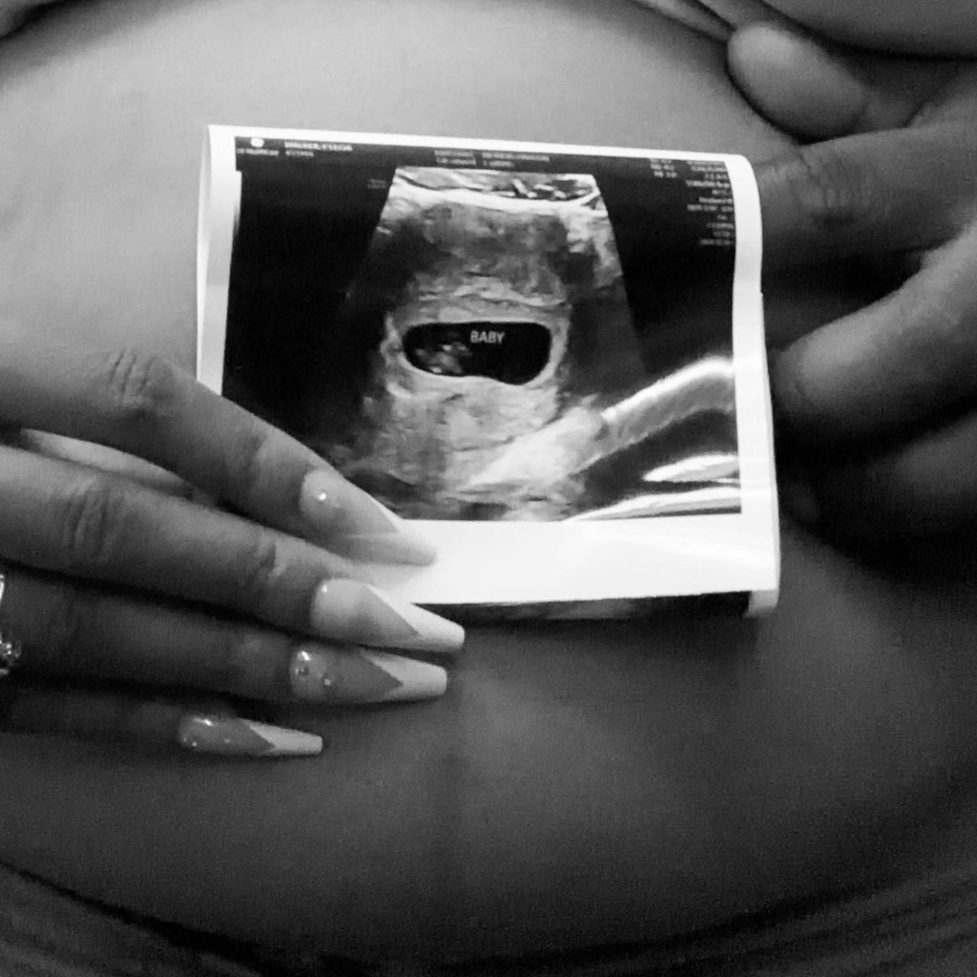 Photo shared by E'lecia for their Babylist baby registry.