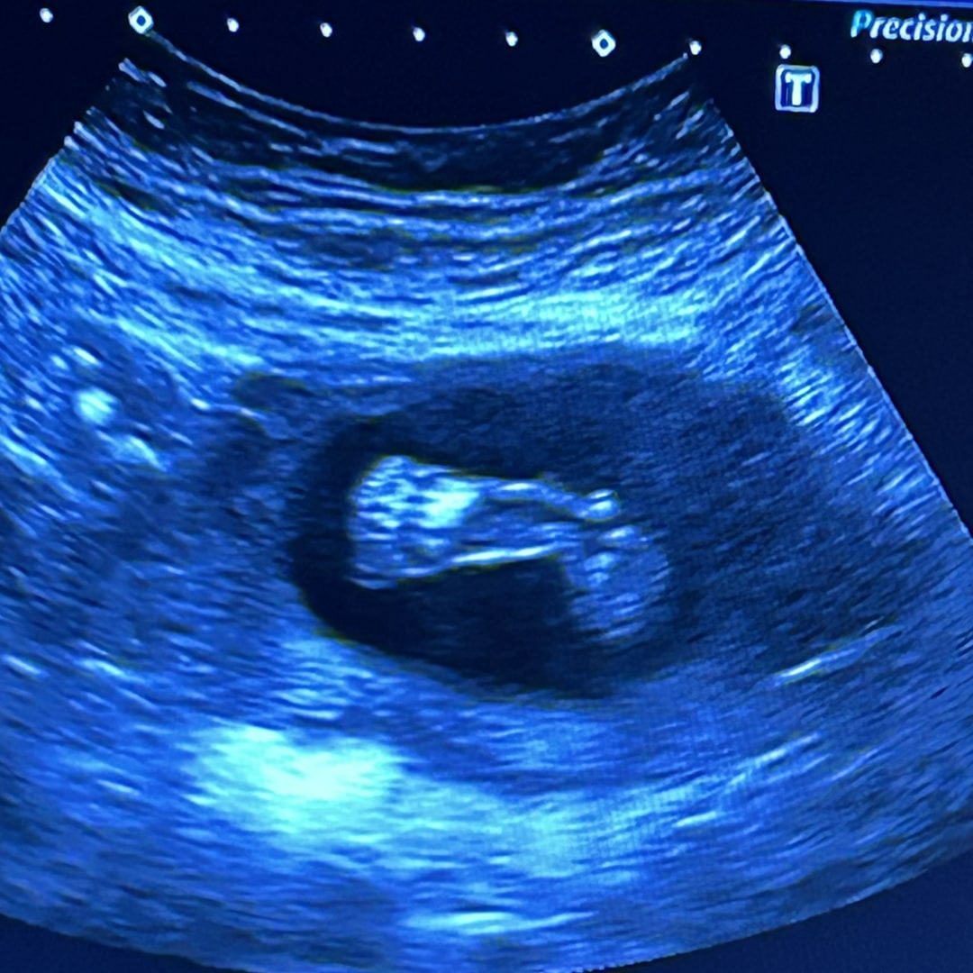 Photo shared by Alanis for their Babylist baby registry.