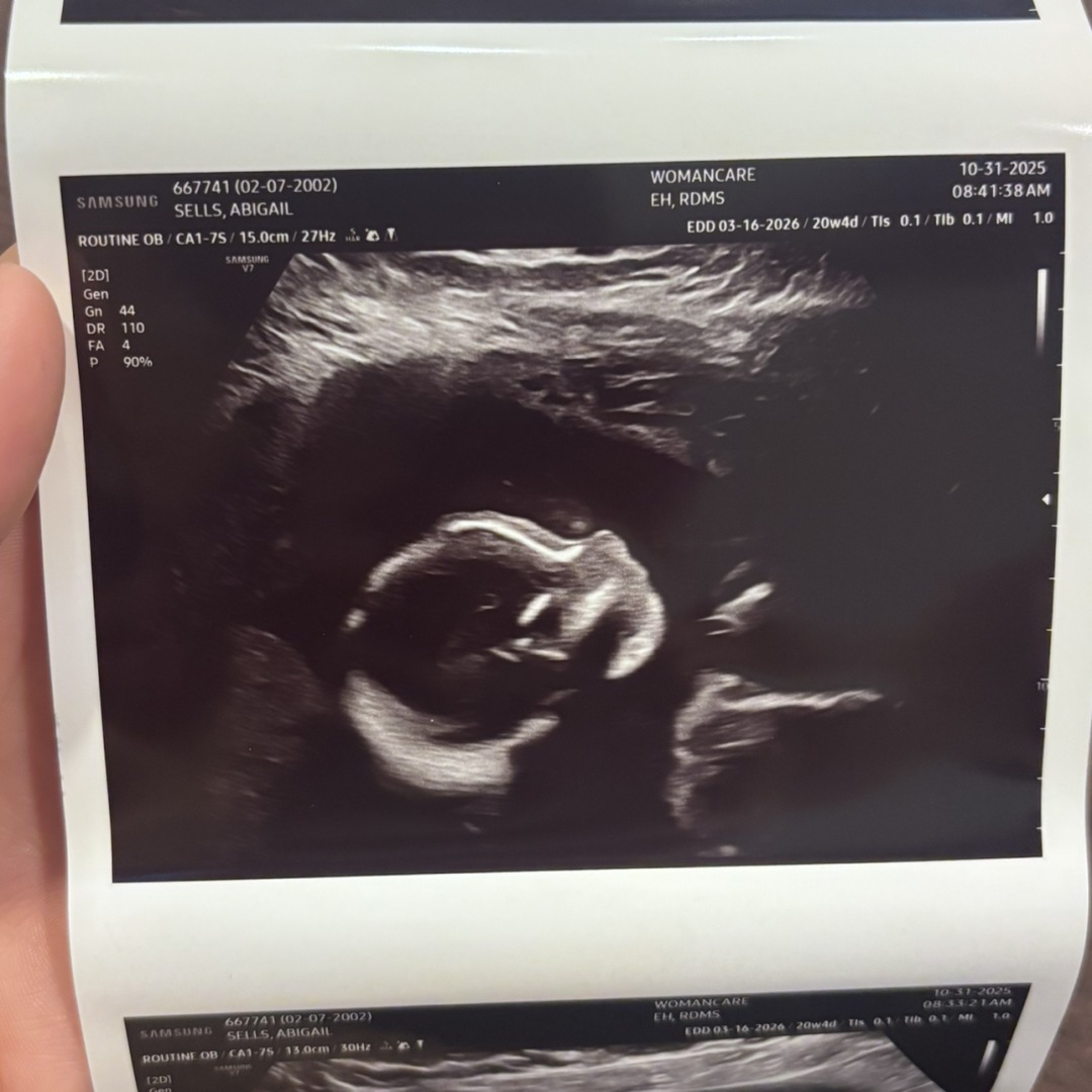 Photo shared by Abby for their Babylist baby registry.