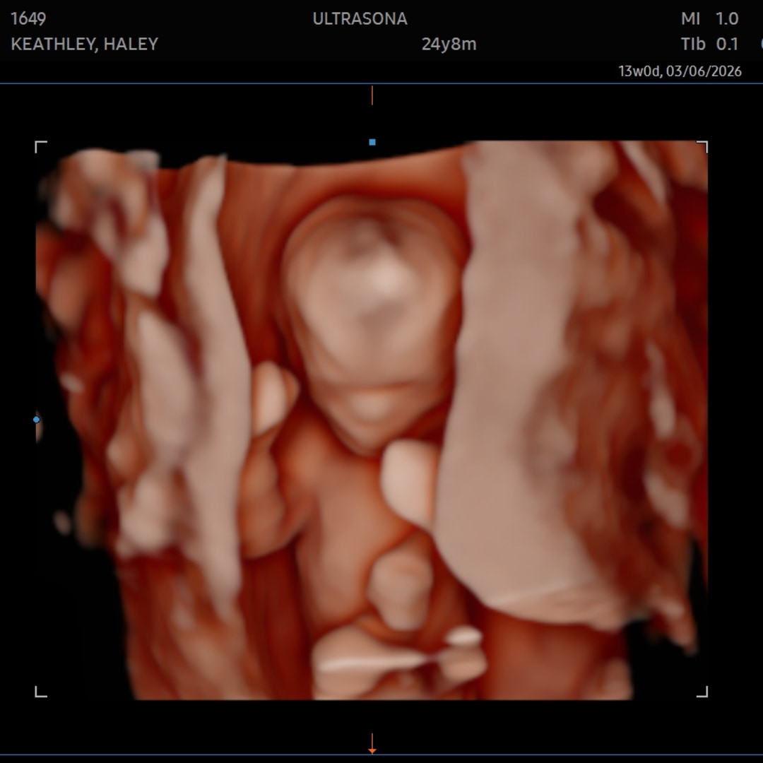 Photo shared by Haley for their Babylist baby registry.