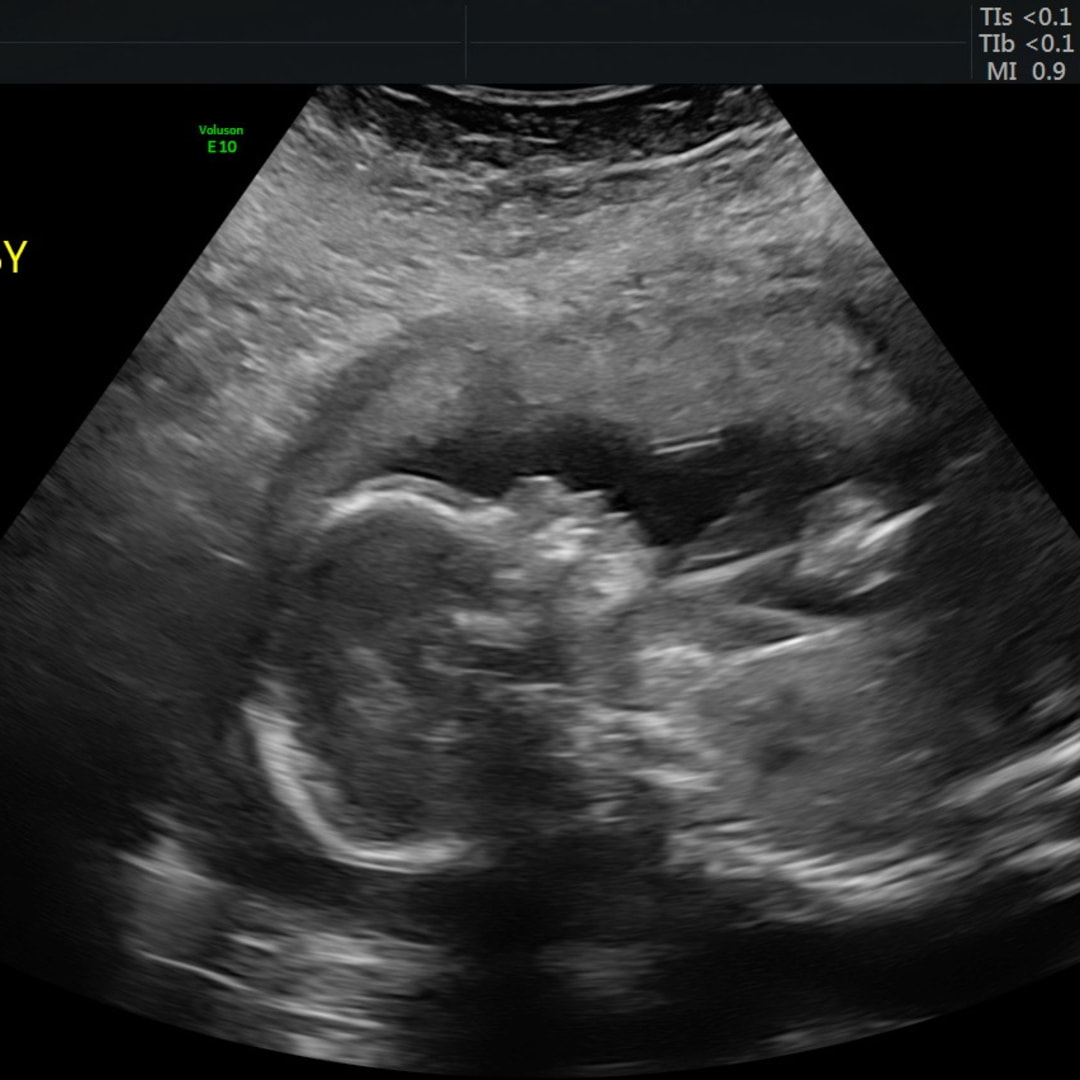 Photo shared by MaKenna for their Babylist baby registry.