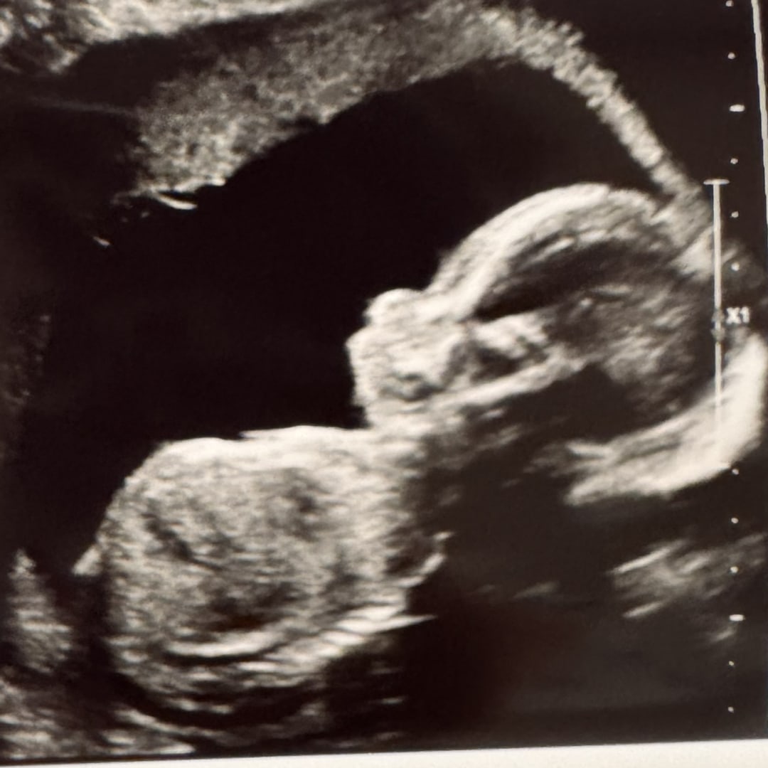 Photo shared by Haley for their Babylist baby registry.