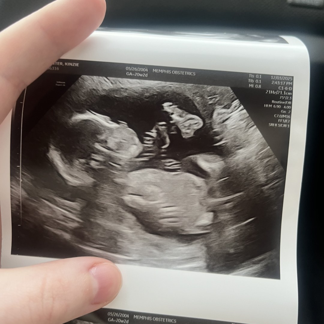 Photo shared by Kinzie for their Babylist baby registry.