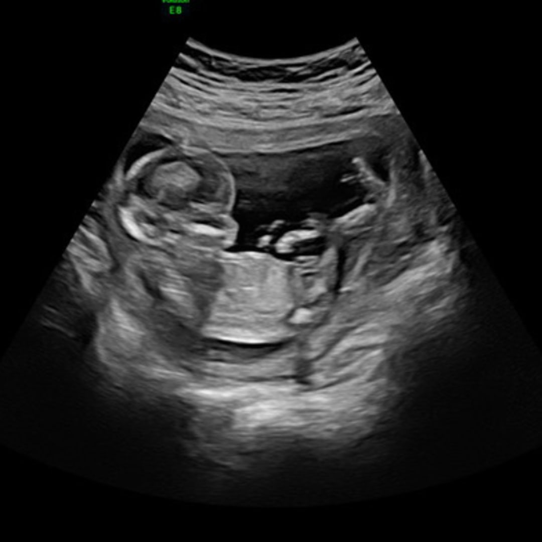 Photo shared by Bo for their Babylist baby registry.