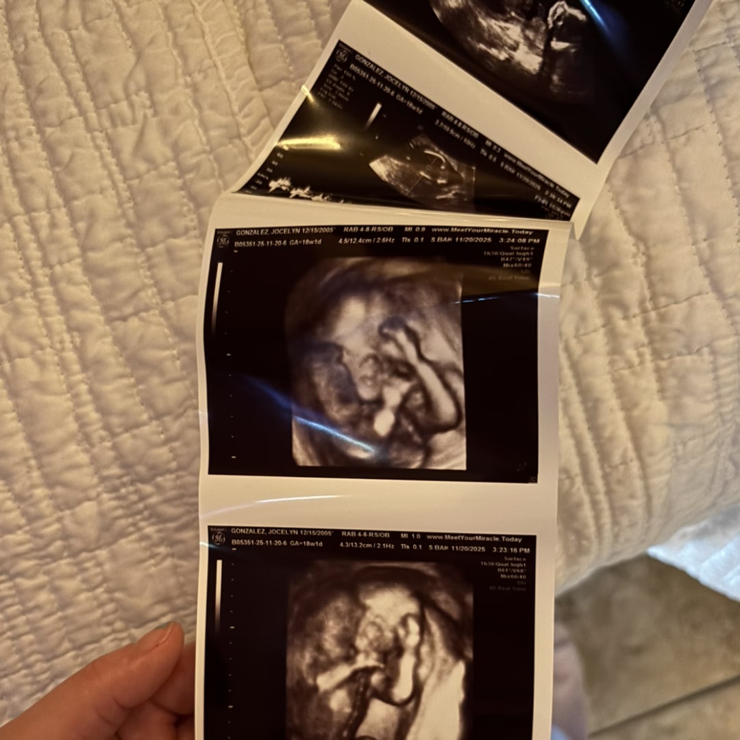 Photo shared by Jocelyn for their Babylist baby registry.