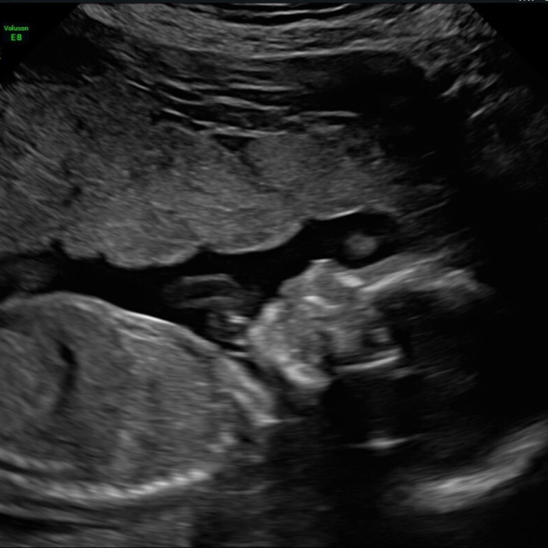 Photo shared by Kelsie for their Babylist baby registry.