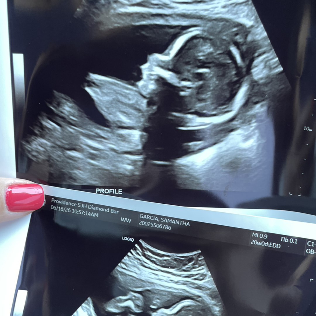 Photo shared by Samantha for their Babylist baby registry.