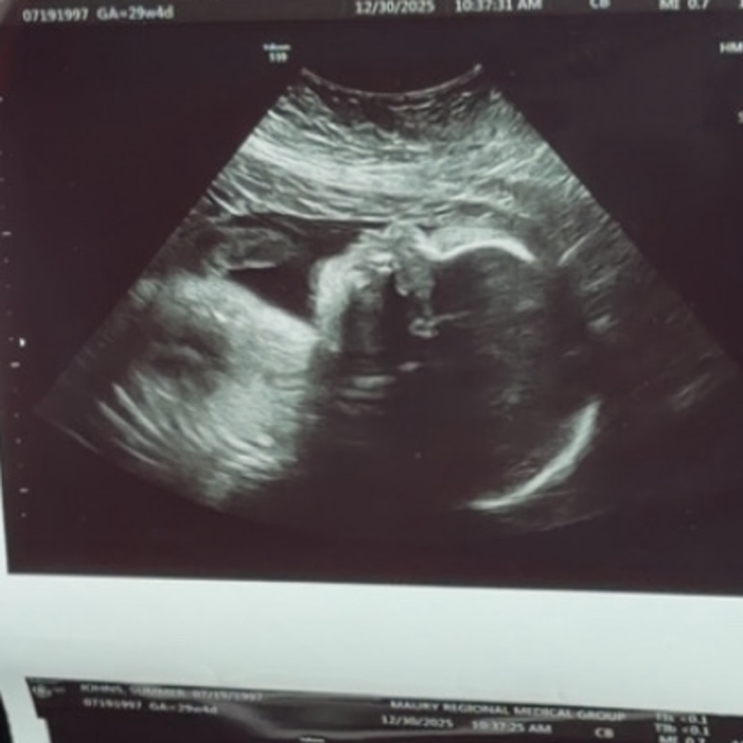 Photo shared by Summer for their Babylist baby registry.