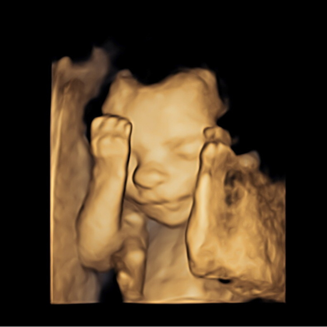 Photo shared by Carly for their Babylist baby registry.