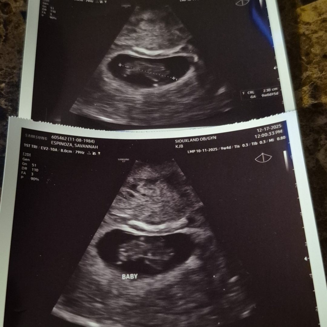 Photo shared by Savannah for their Babylist baby registry.