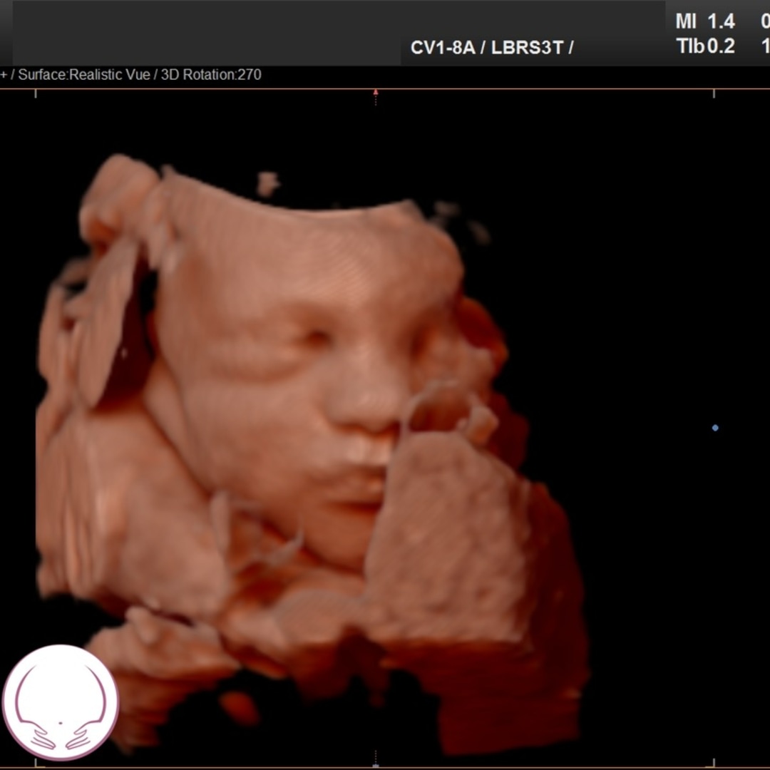 Photo shared by Brooke for their Babylist baby registry.