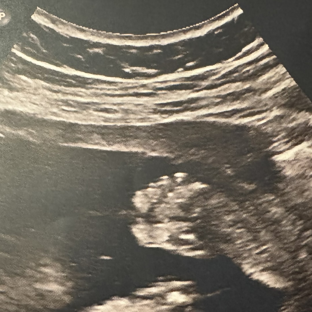 Photo shared by Lili for their Babylist baby registry.