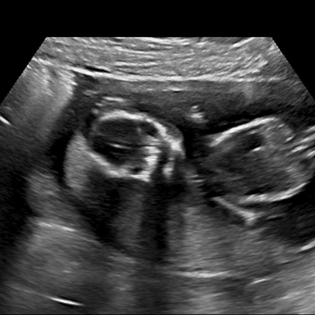 Photo shared by Karen for their Babylist baby registry.