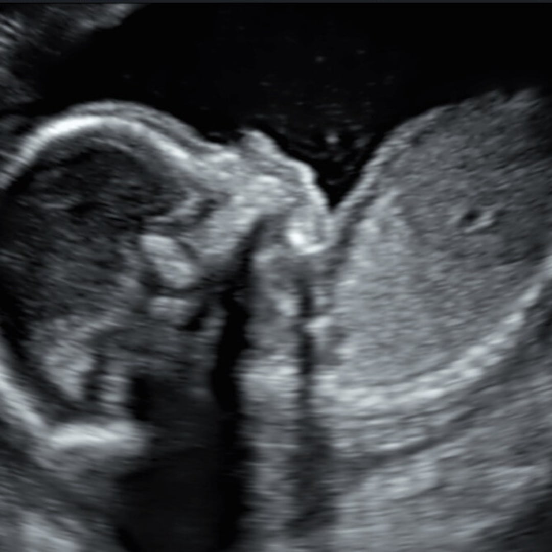 Photo shared by Claire for their Babylist baby registry.