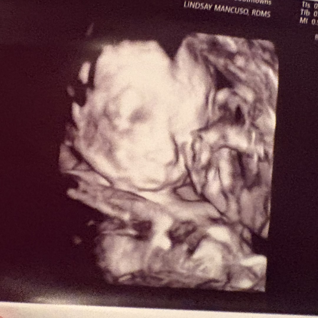 Photo shared by Sophia for their Babylist baby registry.