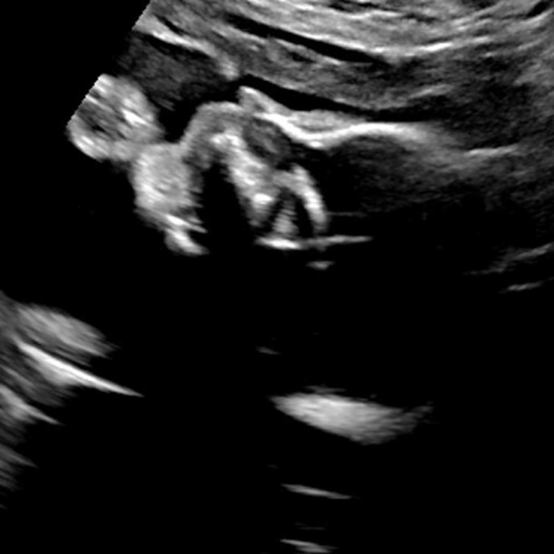 Photo shared by Samantha for their Babylist baby registry.