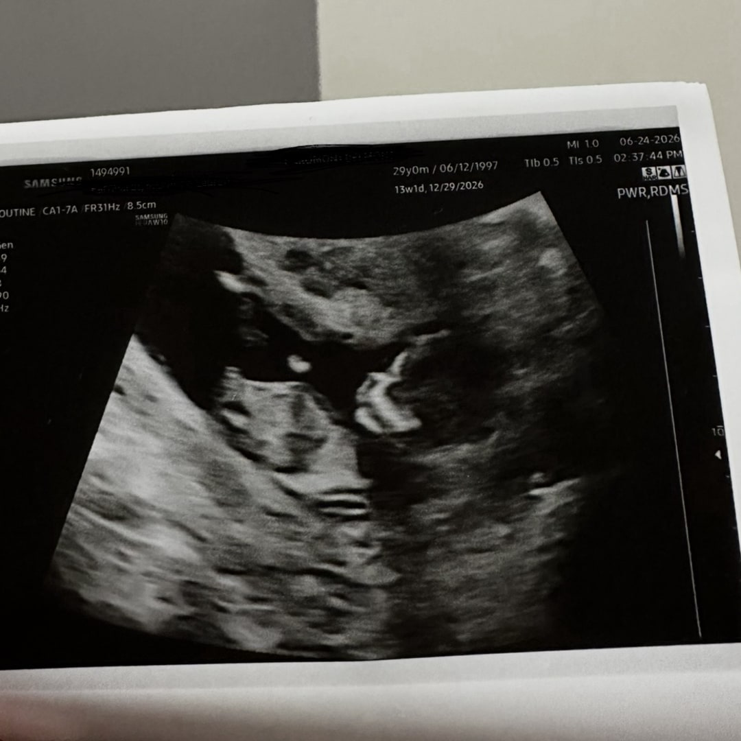 Photo shared by McKenzie for their Babylist baby registry.