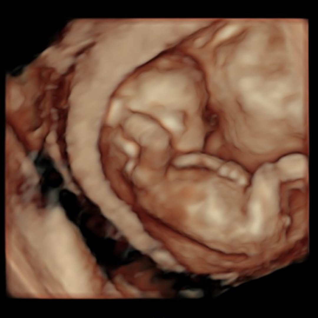 Photo shared by Serena for their Babylist baby registry.