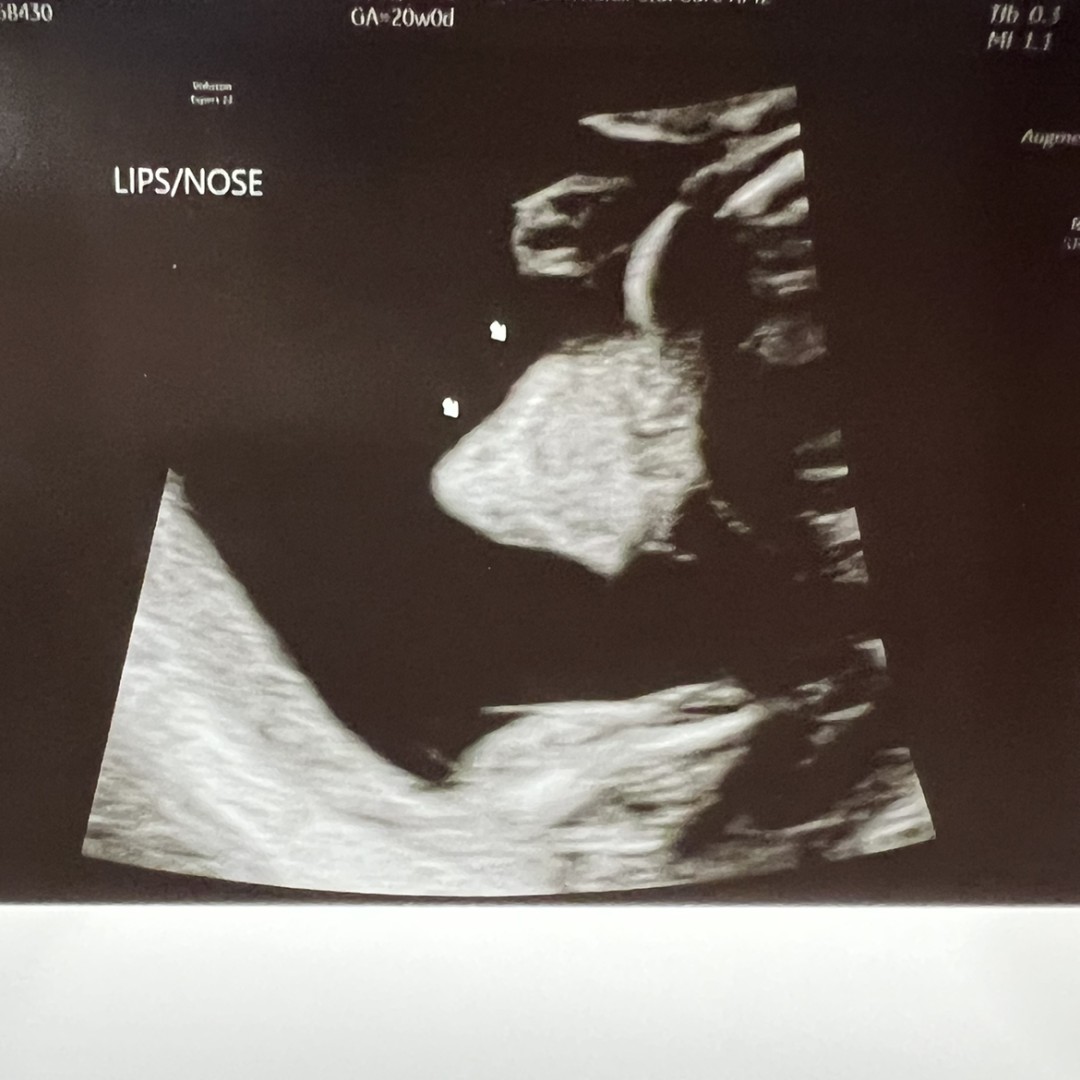 Photo shared by Tillie for their Babylist baby registry.