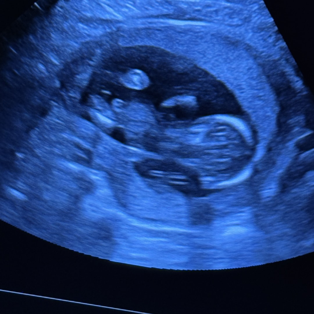 Photo shared by Chelsea for their Babylist baby registry.