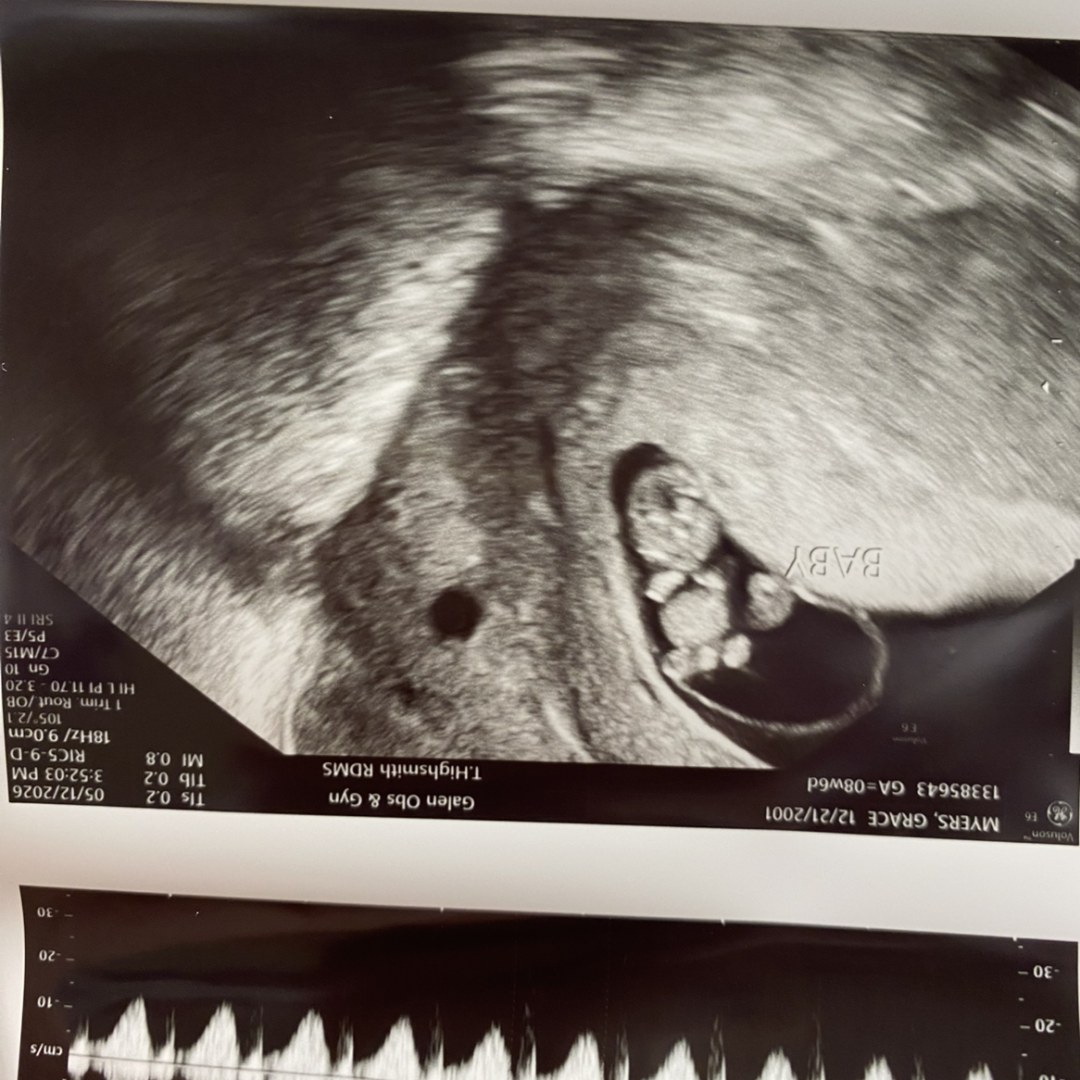 Photo shared by Grace for their Babylist baby registry.