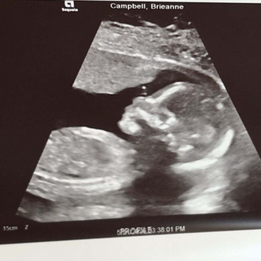 Photo shared by Brieanne for their Babylist baby registry.