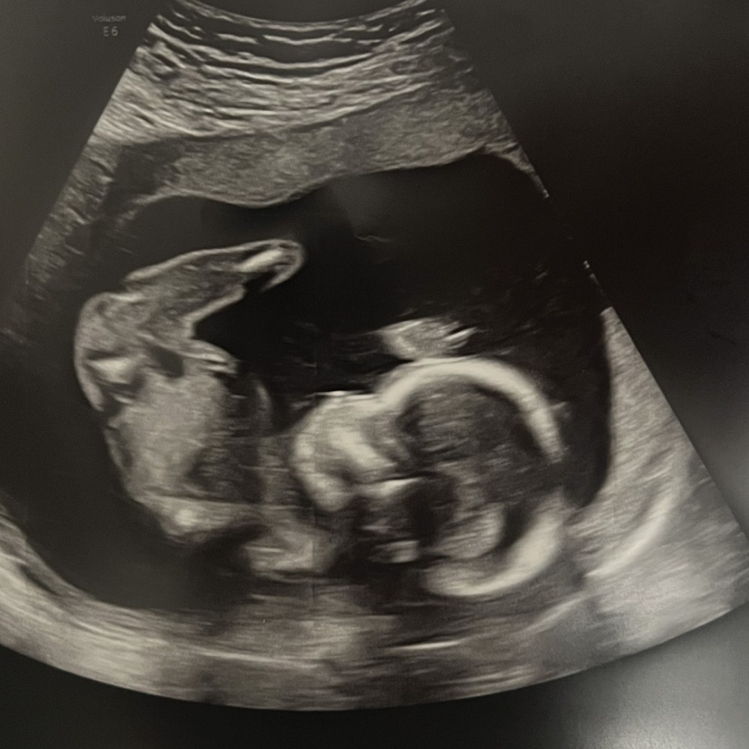 Photo shared by Chloe for their Babylist baby registry.