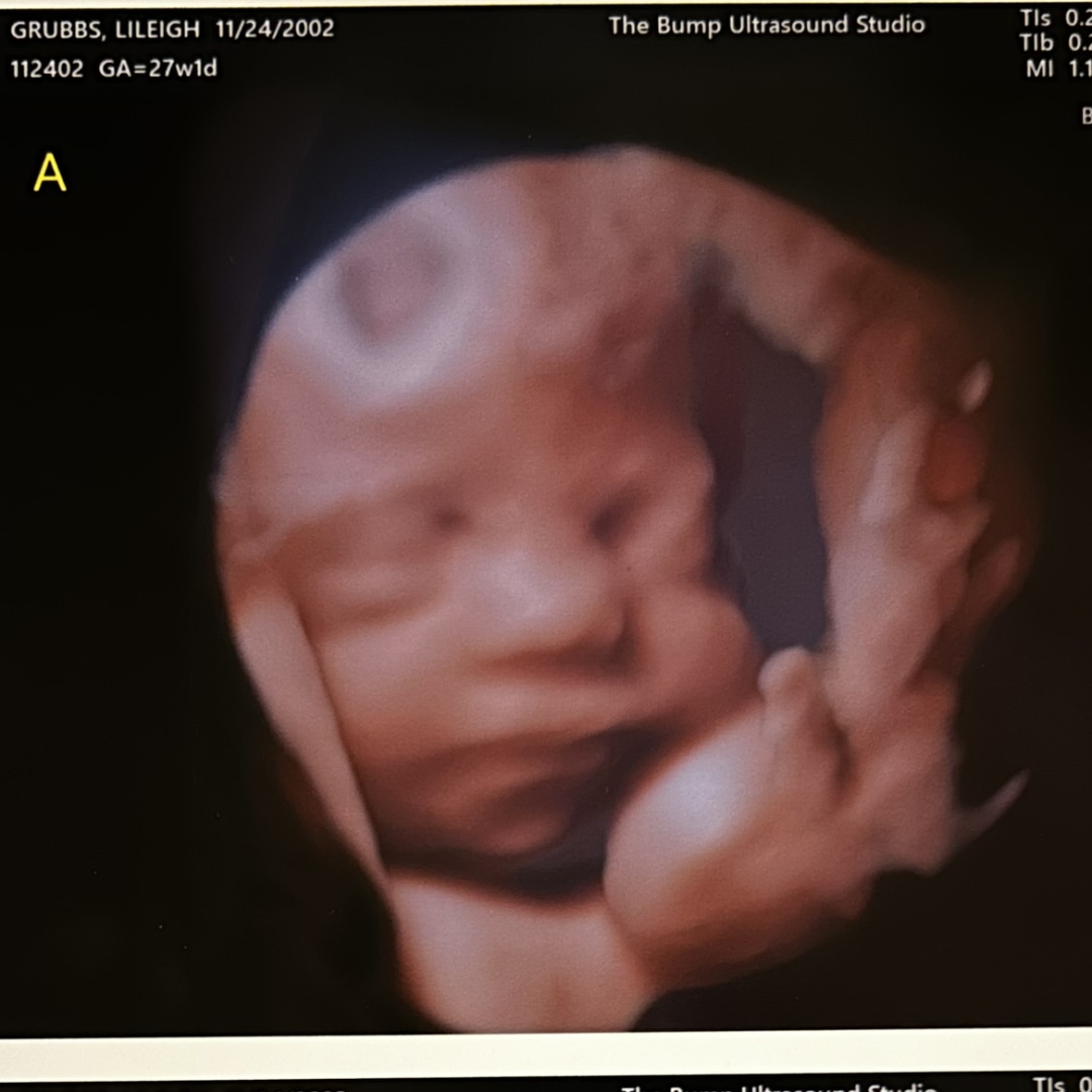 Photo shared by Lileigh for their Babylist baby registry.