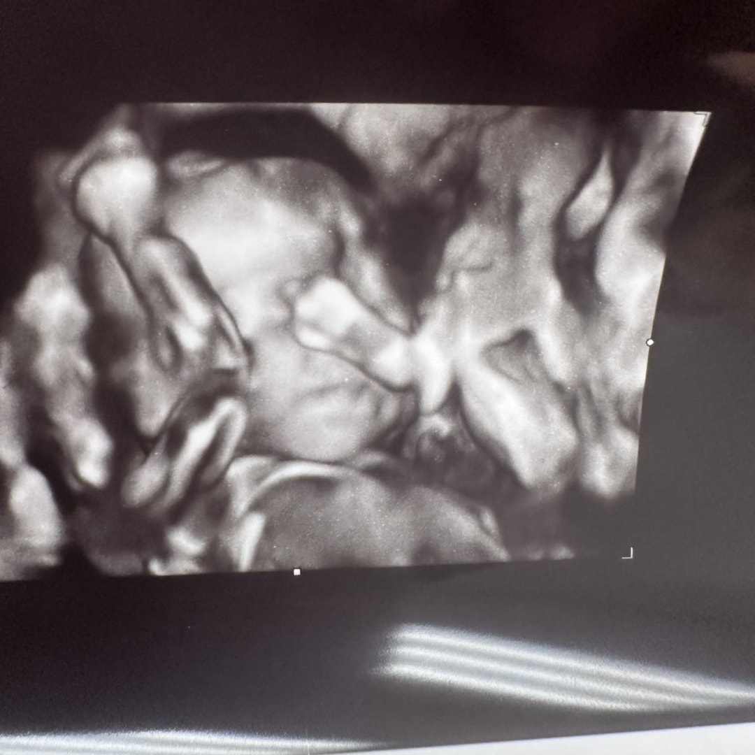 Photo shared by Brandi for their Babylist baby registry.