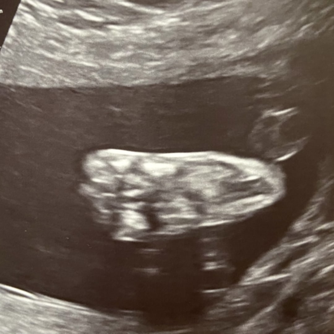 Photo shared by Brook for their Babylist baby registry.