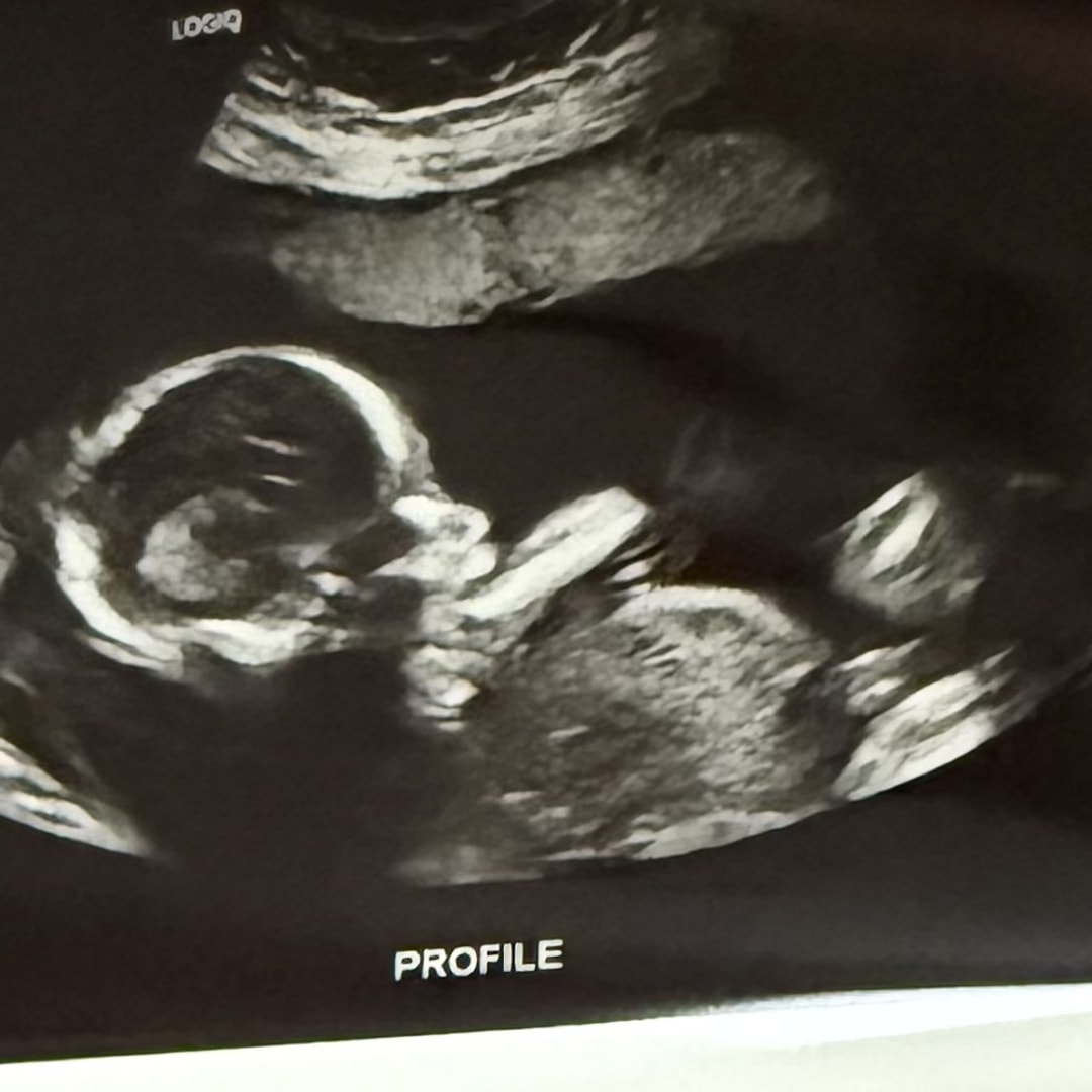 Photo shared by Maddi for their Babylist baby registry.