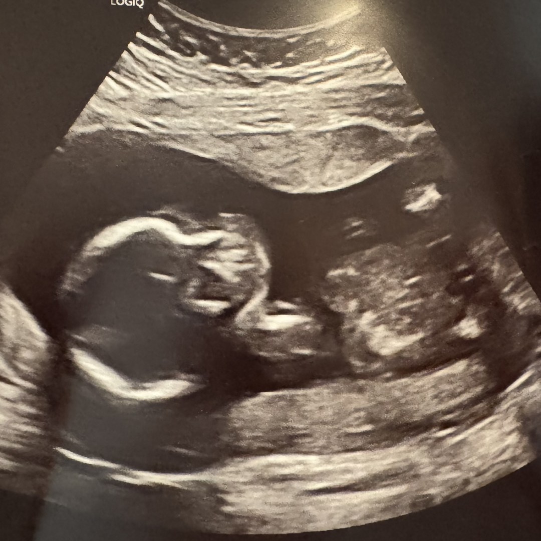 Photo shared by Alina for their Babylist baby registry.